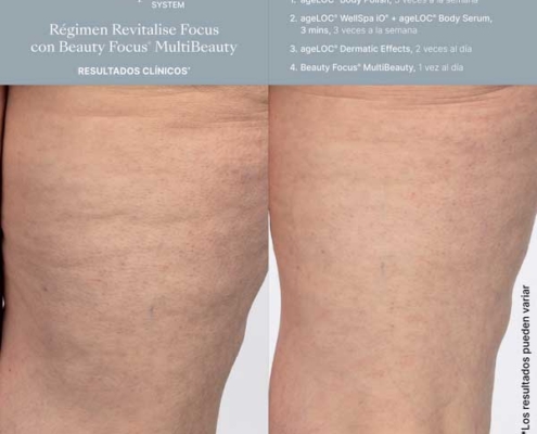 Sistema Better Together WellSpa iO (2) Sistema Better Together WellSpa iO