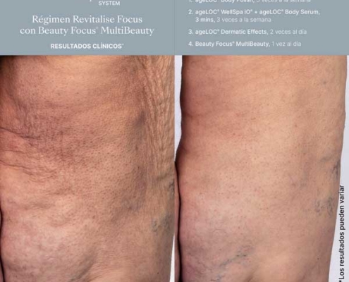 Sistema Better Together WellSpa iO (3) Sistema Better Together WellSpa iO